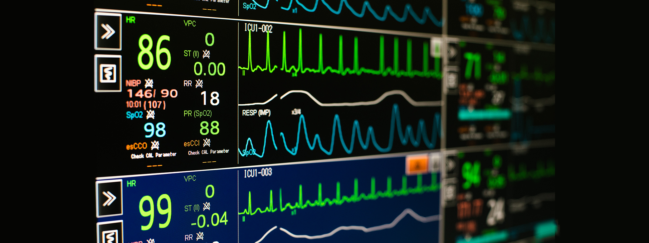 A hospital computer screen with a patient's heartbeat, blood pressure, etc displayed. 